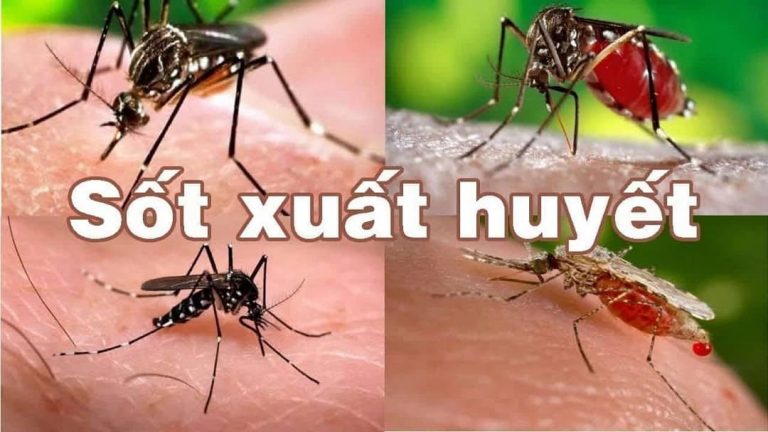 Bệnh sốt xuất huyết là căn bệnh gì?