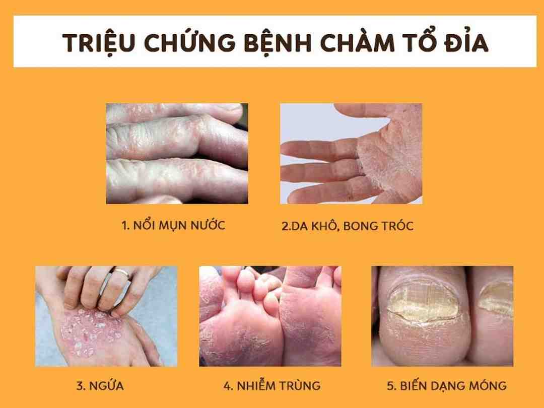 Nhận biết triệu chứng bệnh để kịp thời chữa trị hiệu quả 