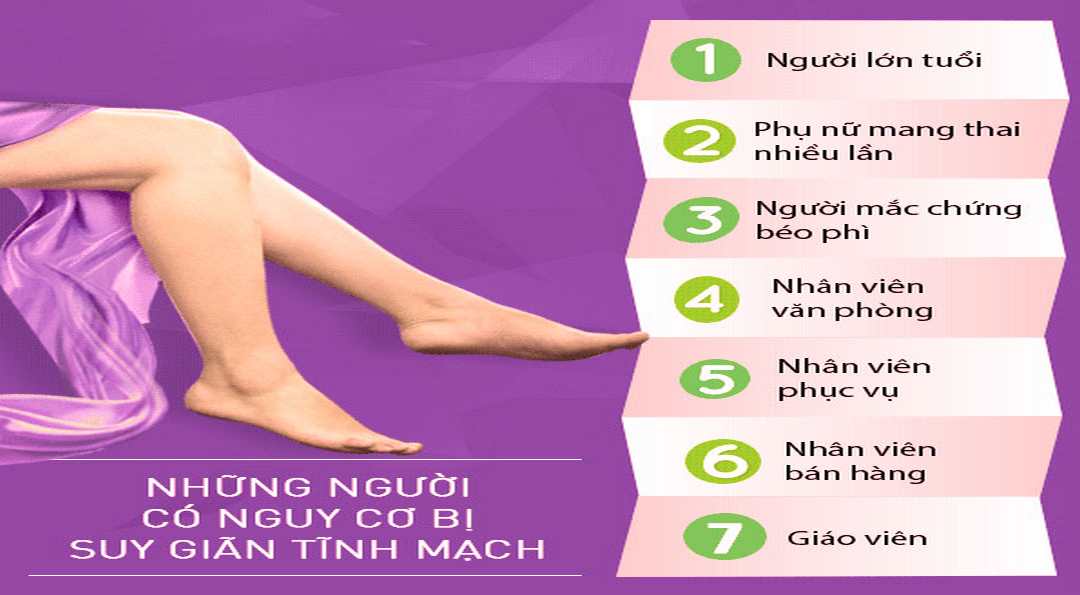 Nhóm đối tượng có nguy cơ bị giãn tĩnh mạch cao