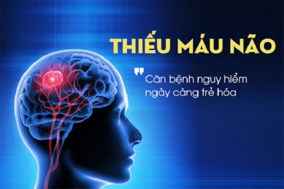 Bệnh thiếu máu não