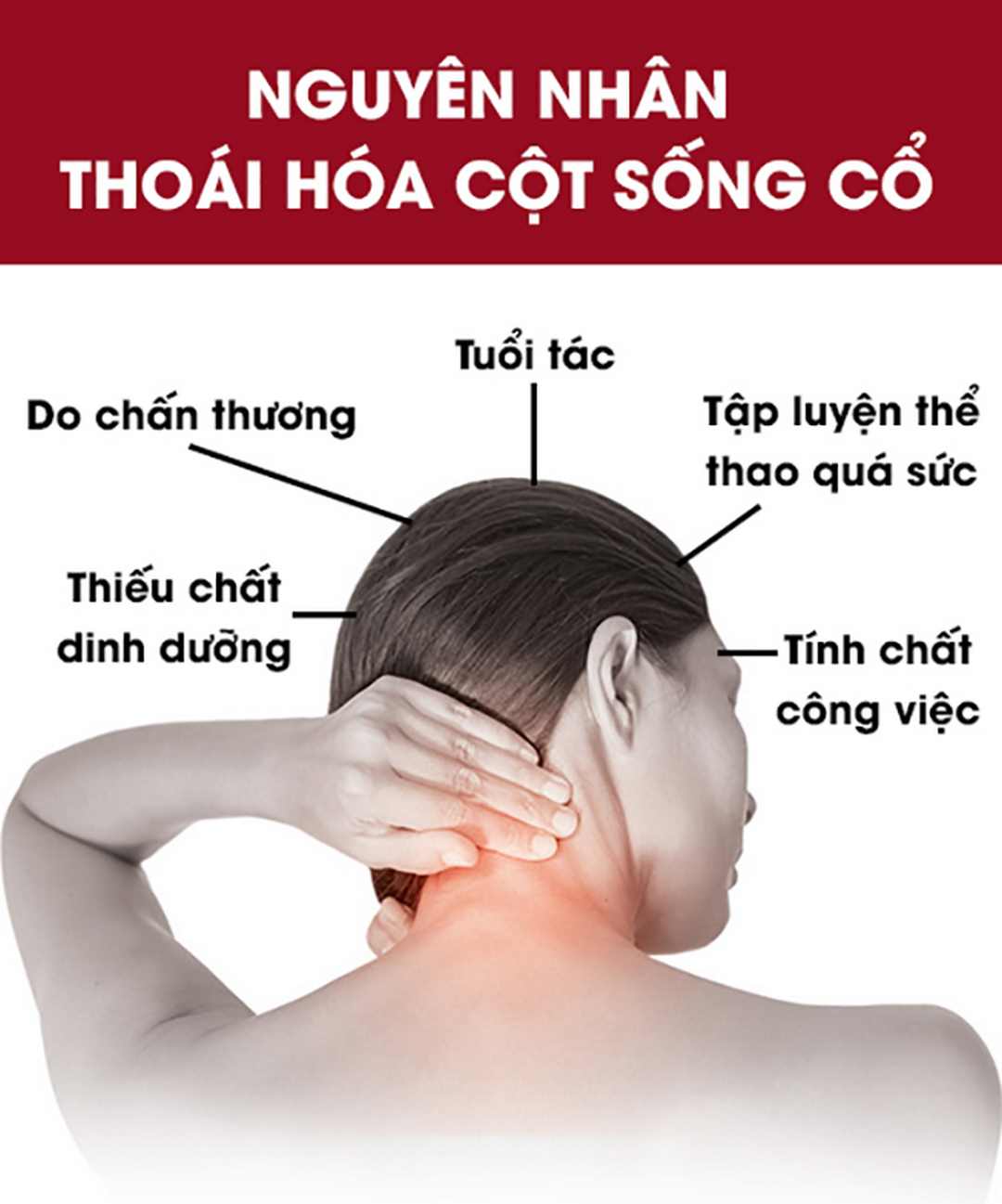 Một số nguyên nhân gây nên căn bệnh đốt sống cổ