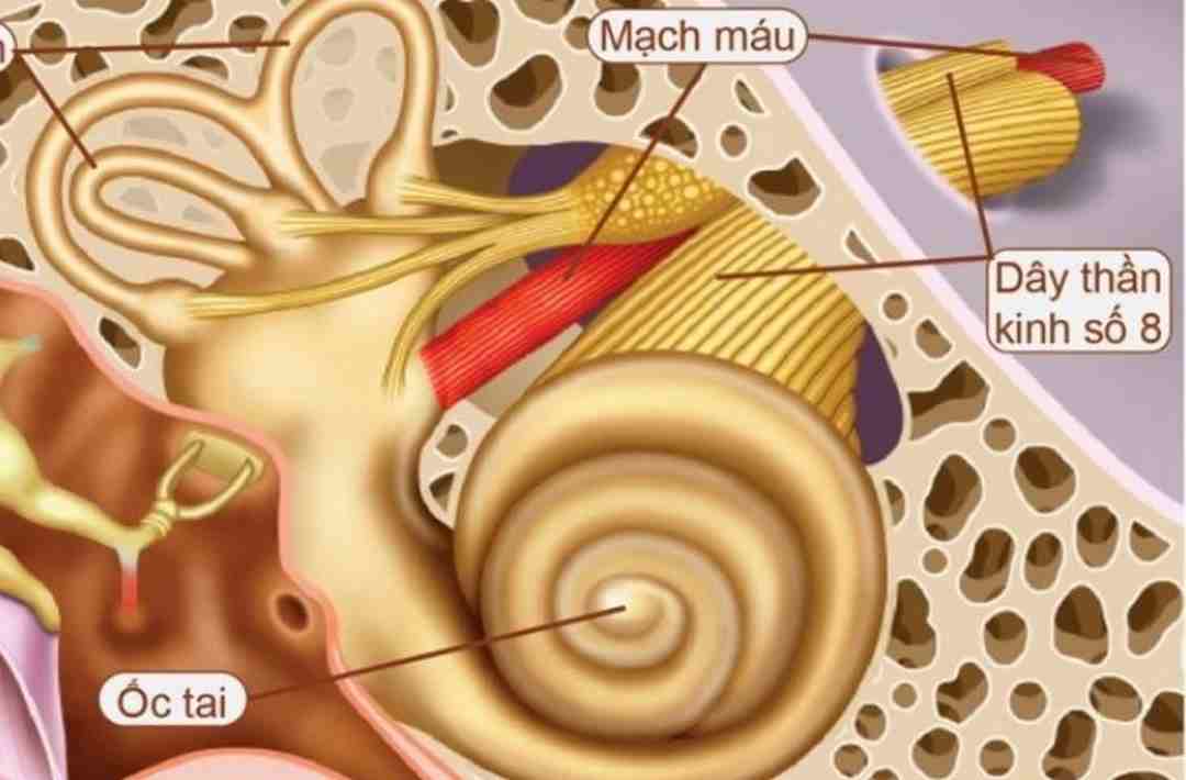 Dây thần kinh bị tổn thương gây ù tai