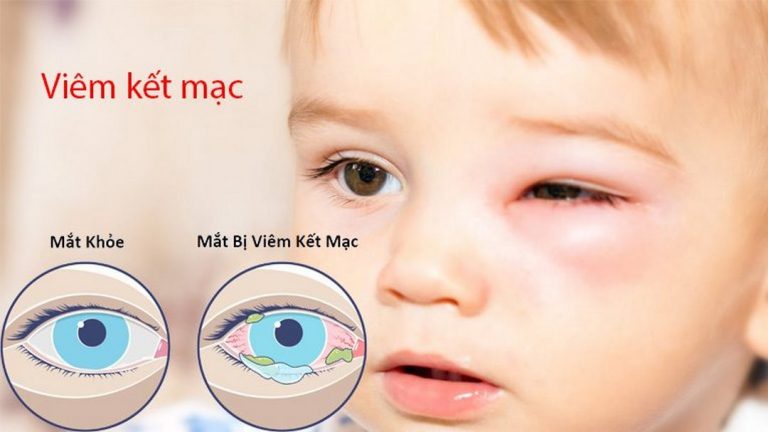 Sự khác biệt lớn giữa mắt khỏe và mắt đang bị bệnh 