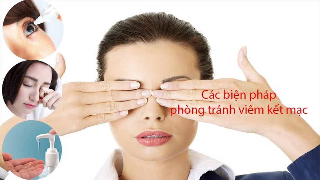 Các biện pháp phòng chống viêm kết mạc cần biết