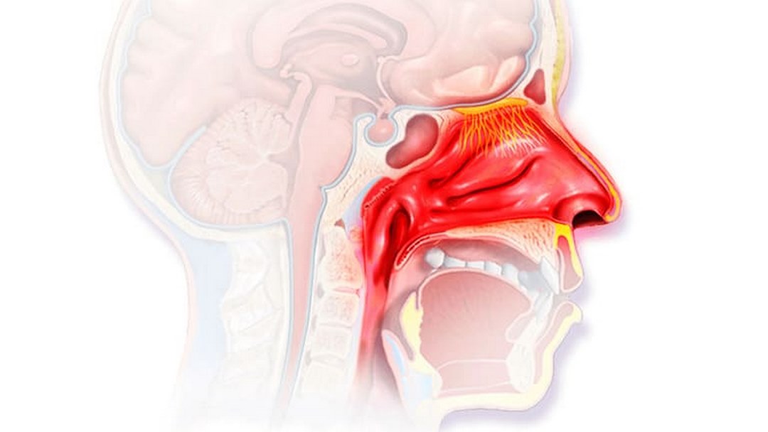 Bệnh sẽ gây ra hậu quả khôn lường nếu không điều trị đúng cách