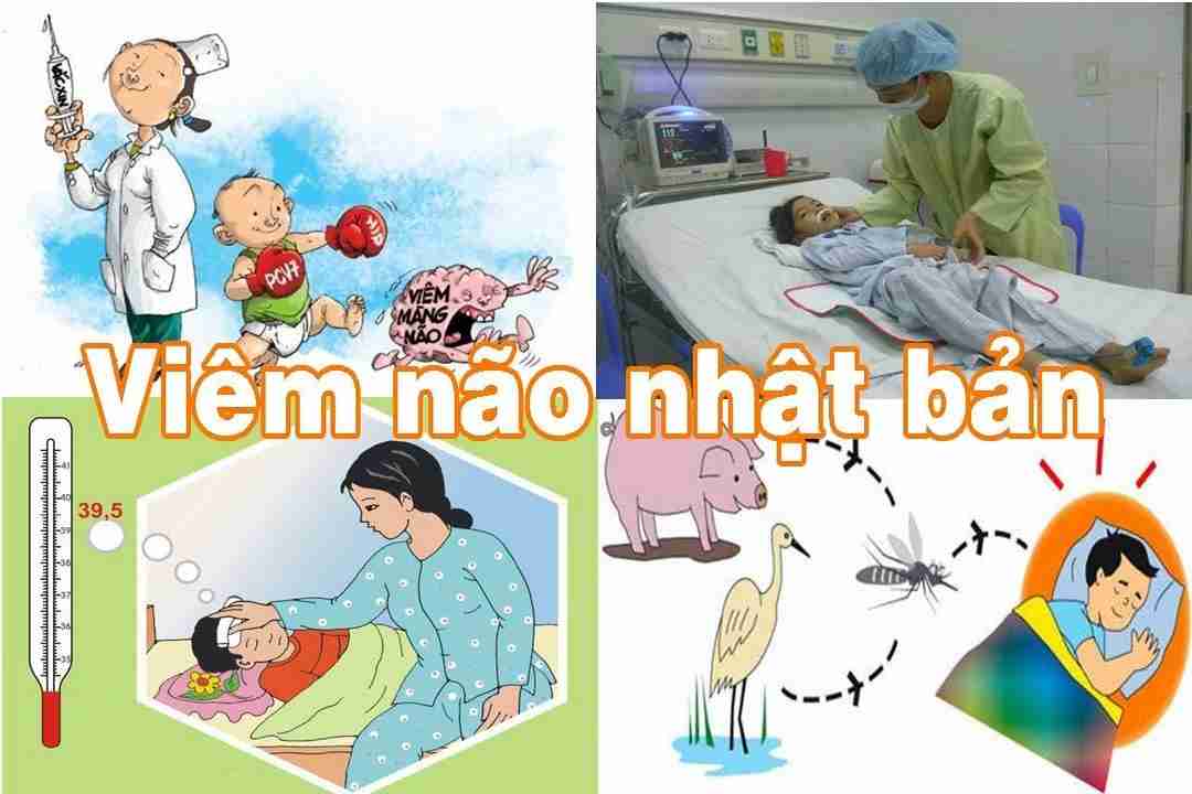 Bệnh viêm não này thường gặp ở trẻ em dưới 15 tuổi