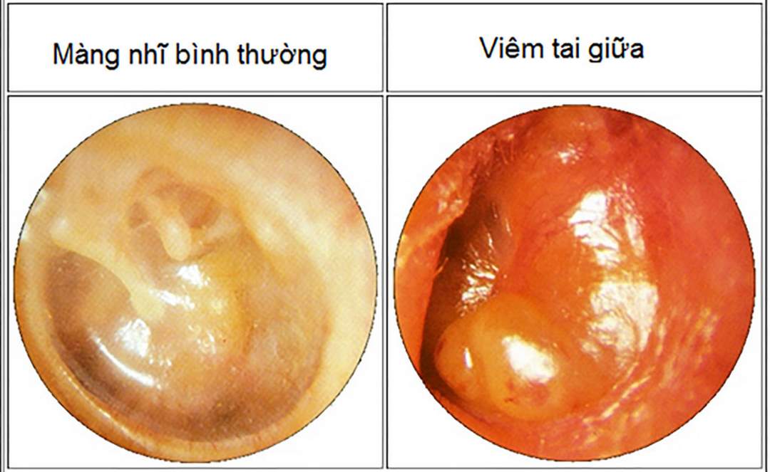 Bệnh lý này làm ảnh hưởng lớn đến cuộc sống người bệnh