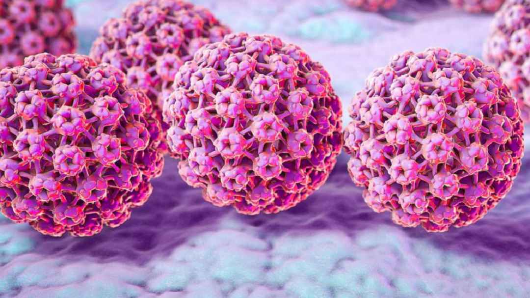 Mụn cóc sinh dục do chủng vi rút HPV 6 và 11 gây ra