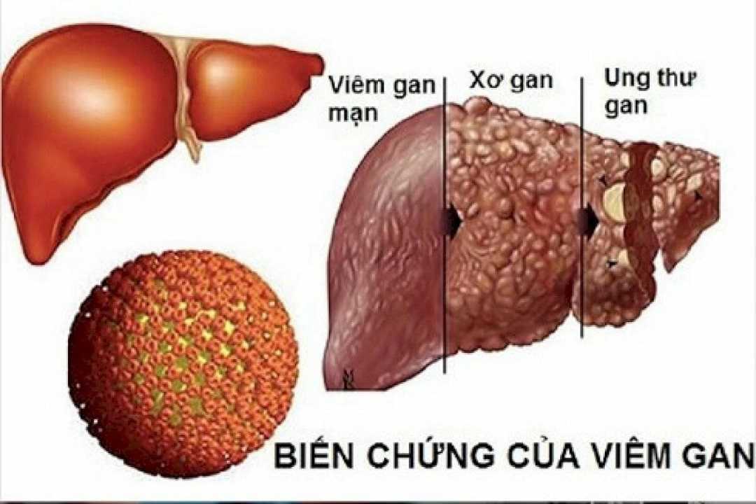 Khi nào cần gặp chuyên gia?