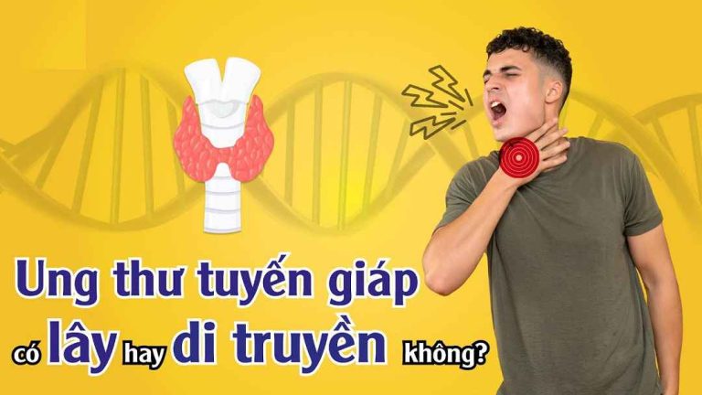 Ung thư tuyến giáp có lây không?