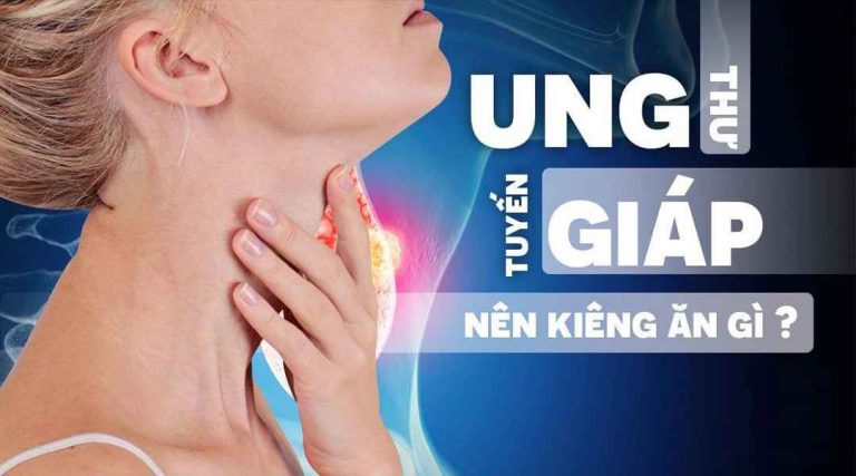 Những thực phẩm người u tuyến giáp nên tránh