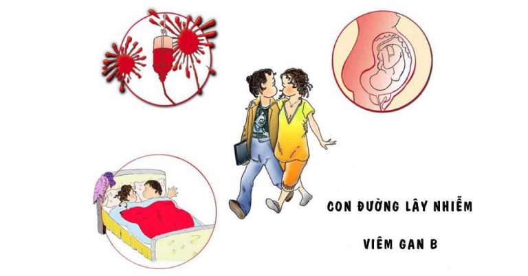 Các đường lây truyền virus viêm gan B?