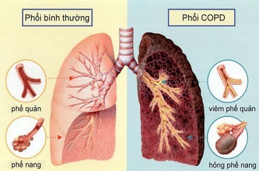 Nên ăn uống lành mạnh và vệ sinh sạch sẽ