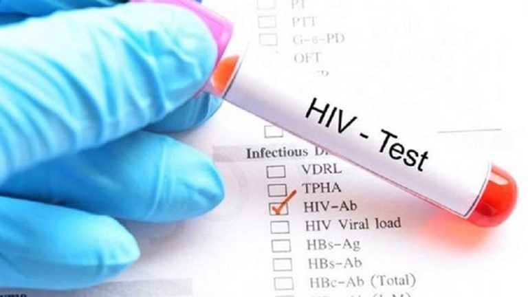 Các bước để đánh giá hiệu quả điều trị HIV