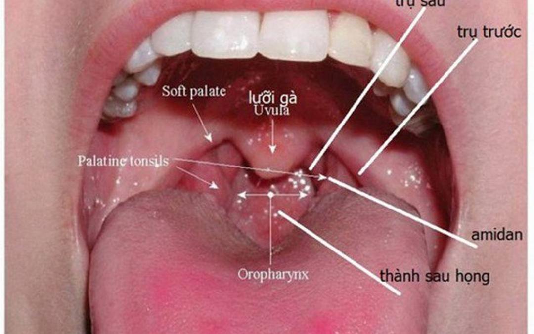 Điều trị ung thư vòm họng bằng các phương pháp phổ biến